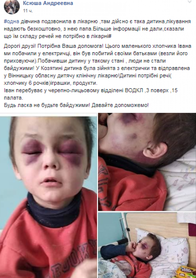 Новини Вінниці - фото з Гематоми та черепно-мозкова: підозрюють, що батько познущався над 6-річним сином Гематоми та черепно-мозкова: підозрюють, що батько познущався над 6-річним сином, фото №1 на сайті 20minut.ua