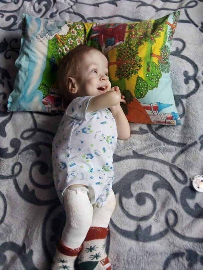 “Я вірю, що мій син зможе одужати”: Тадейчику з Тернопільщини потрібна допомога, фото №1 на сайті 20minut.ua