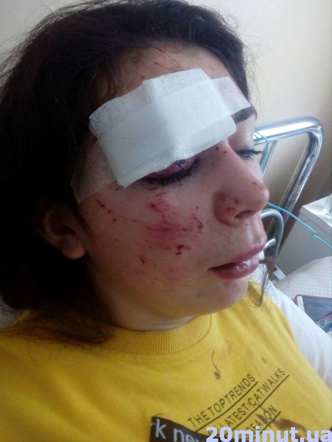 Новини Тернополя - фото з Нічна аварія біля Прошової за участю поліцейських: постраждала  каже, що у неї не беруть показів Нічна аварія біля Прошової за участю поліцейських: постраждала  каже, що у неї не беруть показів, фото №4 на сайті 20minut.ua