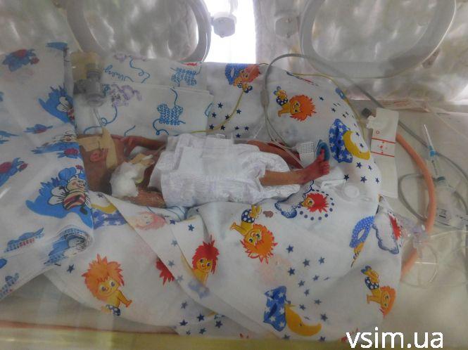 Її вага 540 грамів, а вона вже “борець”: у хмельницькому пологовому народилося недоношене немовля, фото №2 на сайті vsim.ua