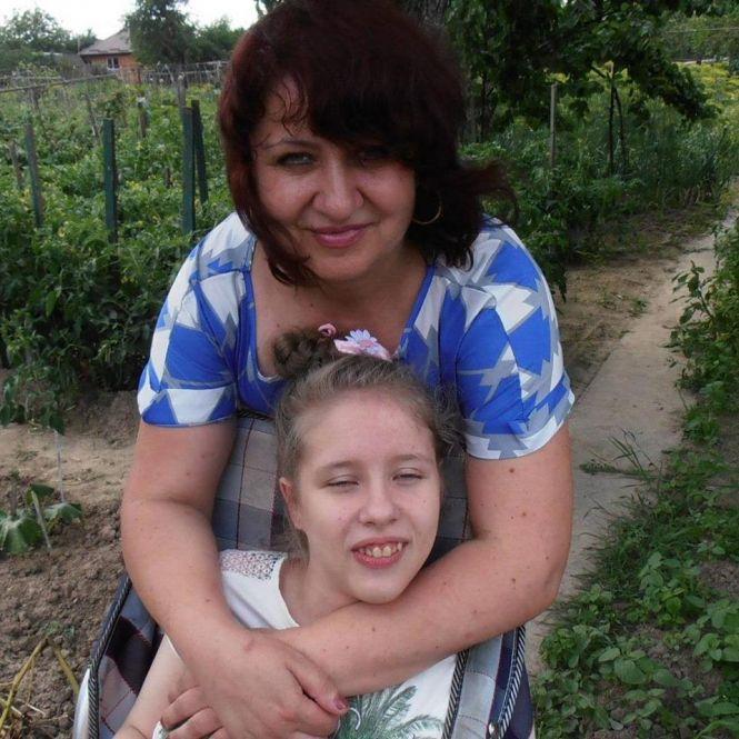 Юній вінничанці Валерії необхідне лікування в Китаї. Родині потрібна допомога, фото №2 на сайті 20minut.ua