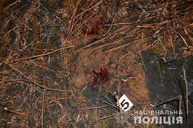 Новини Тернополя - фото з На Тернопільщині під час сварки чоловік 20 разів вдарив ножем дружину та себе На Тернопільщині під час сварки чоловік 20 разів вдарив ножем дружину та себе, фото №2 на сайті 20minut.ua