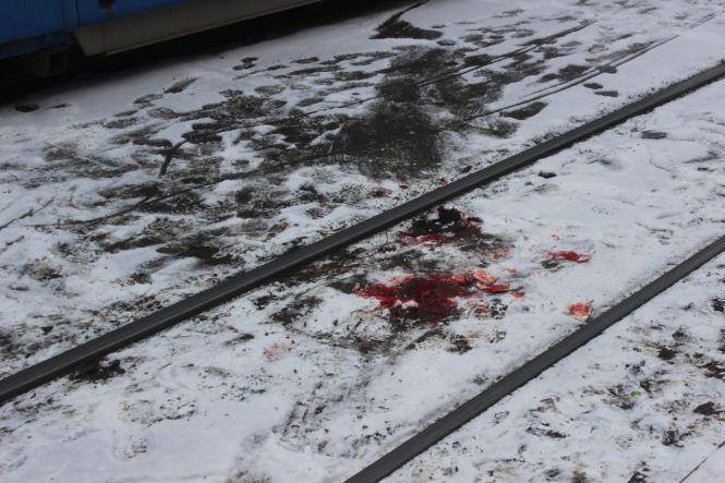 Новини Вінниці - фото з Сліди крові на снігу: на Замостянській трамвай збив жінку. Особу встановили (ОНОВЛЕНО) Сліди крові на снігу: на Замостянській трамвай збив жінку. Особу встановили (ОНОВЛЕНО), фото №4 на сайті 20minut.ua
