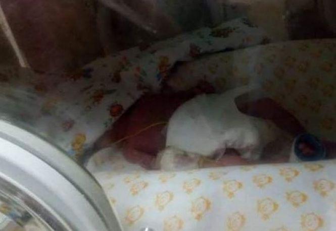 “Ми вже важимо 650 грамів”: крихітній Олесі потрібна допомога хмельничан, фото №1 на сайті vsim.ua