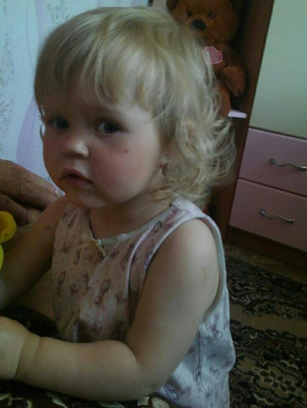 Новини Хмельницького - фото з “8 березня їй виповниться лише два рочки”: допомоги хмельничан потребує маленька Мілана “8 березня їй виповниться лише два рочки”: допомоги хмельничан потребує маленька Мілана, фото №2 на сайті vsim.ua