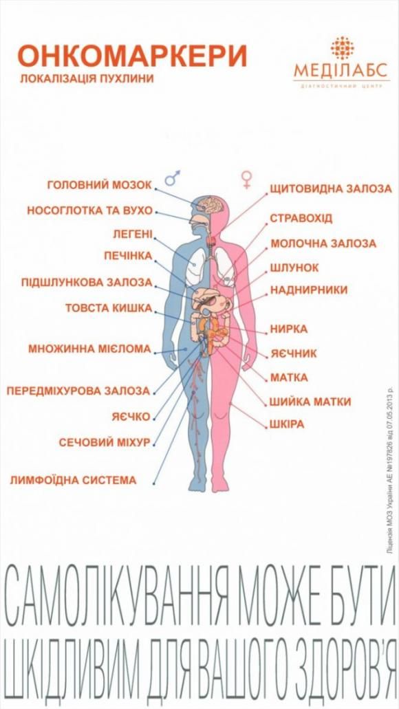 Новини Вінниці - фото з Своєчасна діагностика - ключ до порятунку життя (Новини компаній) Своєчасна діагностика - ключ до порятунку життя (Новини компаній), фото №1 на сайті 20minut.ua