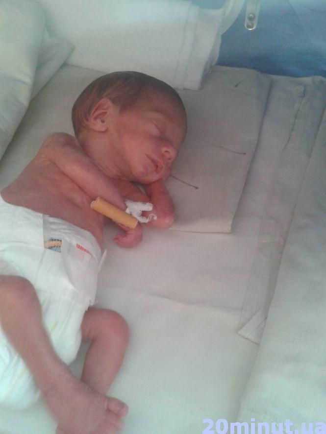 "Ранні пташки": чому діти народжуються передчасно, фото №1 на сайті 20minut.ua