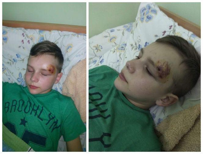 Новини Вінниці - фото з «Ніби собаку збив на дорозі». Зніс дитину на пішохідному переході і навіть не вибачився «Ніби собаку збив на дорозі». Зніс дитину на пішохідному переході і навіть не вибачився, фото №2 на сайті 20minut.ua