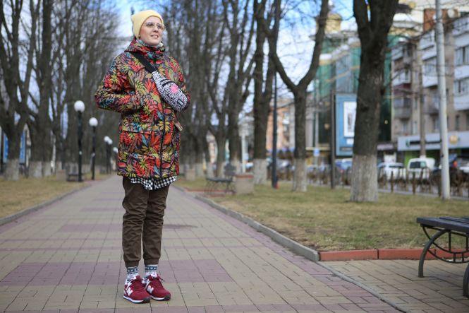 «Перші три місяці я ходила і думала про смерть»: дівчина з раком молочної залози, фото №7 на сайті 20minut.ua