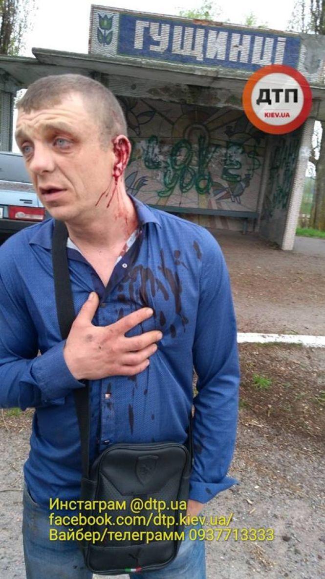 Новини Вінниці - фото з Під Вінницею п’яний «в мотлох» водій на «дев’ятці» врізався в зупинку (ФОТО) Під Вінницею п’яний «в мотлох» водій на «дев’ятці» врізався в зупинку (ФОТО), фото №1 на сайті 20minut.ua