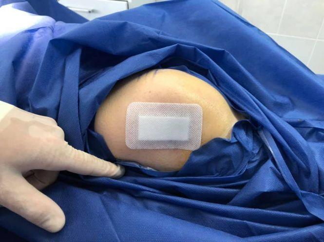 Новини Вінниці - фото з Стовбуровими клітинами без операцій у Пироговці лікують остеоартрози Стовбуровими клітинами без операцій у Пироговці лікують остеоартрози, фото №4 на сайті 20minut.ua