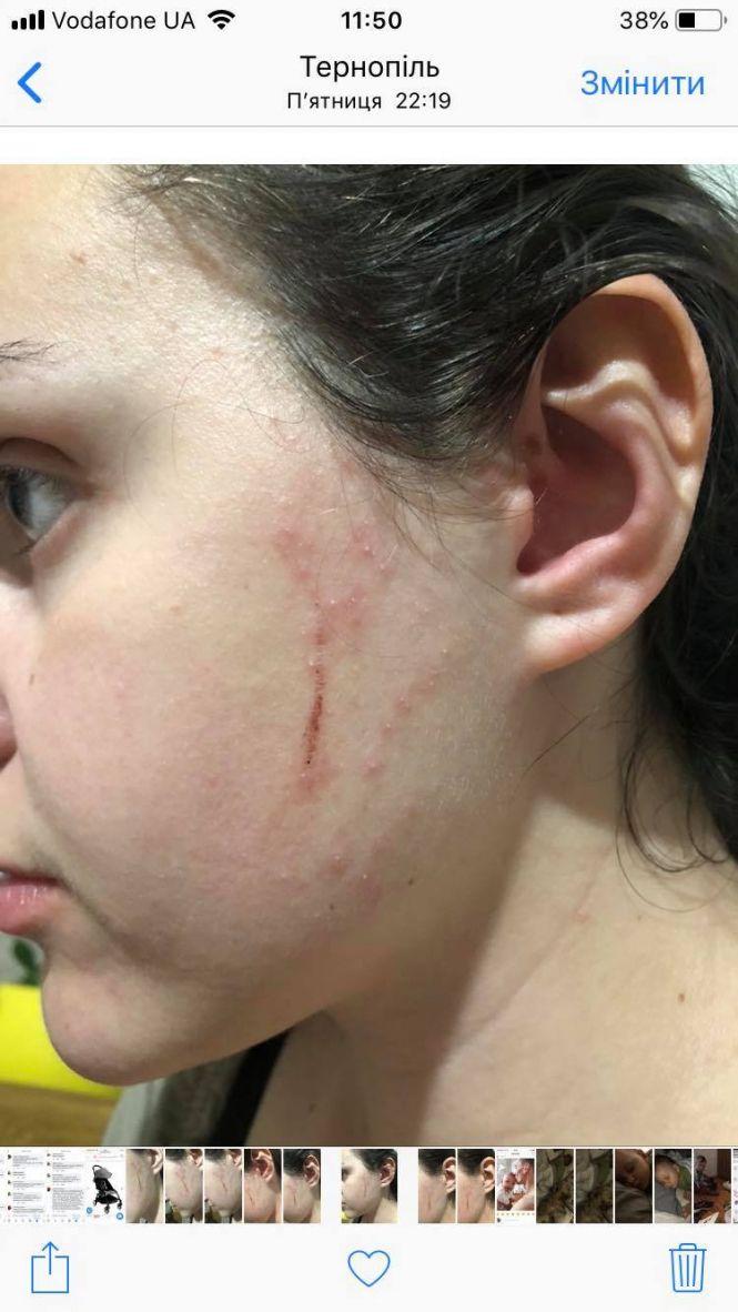 Тернополянина звинувачують в побитті жінки і її собаки. Чоловік публічно просить вибачення, фото №1 на сайті 20minut.ua