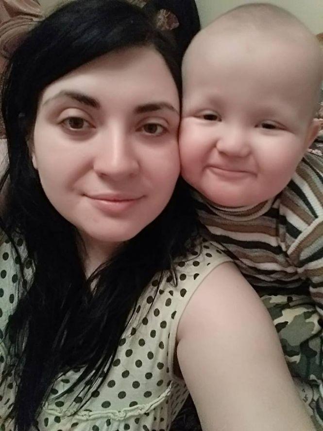 121 хімія та 8 опромінень: як лікарі рятують життя маленького Мілана із Хмельниччини, фото №1 на сайті vsim.ua