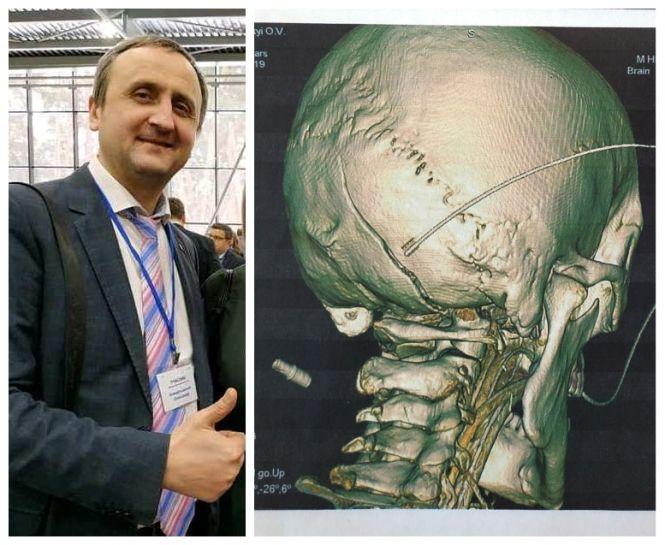 «Моліться за Сашу», — просить дружина покаліченого опером підприємця, бо йому стало гірше, фото №1 на сайті 20minut.ua