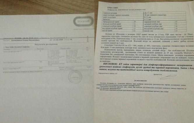 Новини Тернополя - фото з "Один курс хімії коштує 50 тисяч гривень. Треба 6-8 курсів": тернополянка потребує допомоги "Один курс хімії коштує 50 тисяч гривень. Треба 6-8 курсів": тернополянка потребує допомоги, фото №1 на сайті 20minut.ua