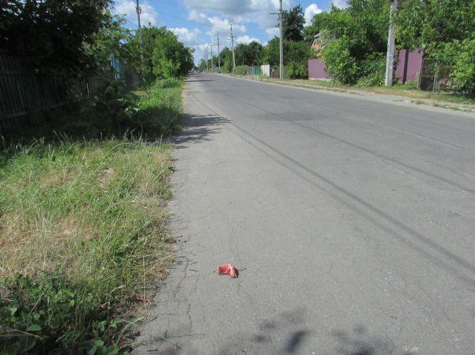 Новини Козятина - фото з Проблема: чому козятинчан атакують собаки підприємців, коли є волонтери для безпритульних собак? Проблема: чому козятинчан атакують собаки підприємців, коли є волонтери для безпритульних собак?, фото №1 на сайті 20minut.ua