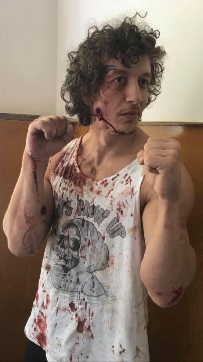 Учні напали на тренера з бодібілдингу: проти одного троє з пістолетом і ножем, фото №1 на сайті 20minut.ua