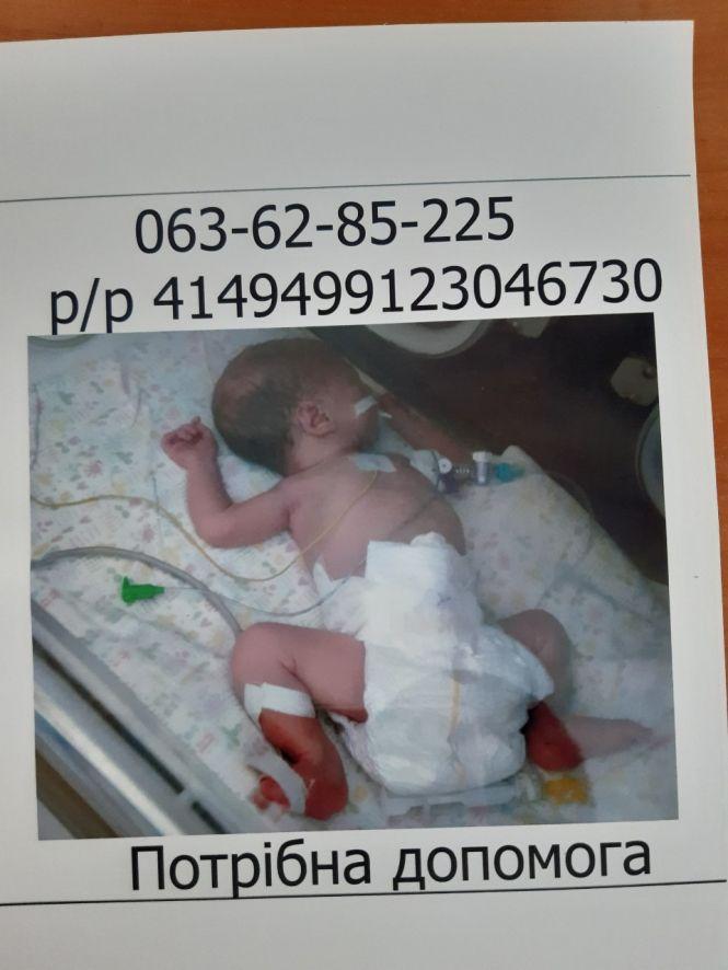 Новини Козятина - фото з Новонародженій Софійці потрібна допомога. Родина збирає кошти на операцію Новонародженій Софійці потрібна допомога. Родина збирає кошти на операцію, фото №2 на сайті 20minut.ua