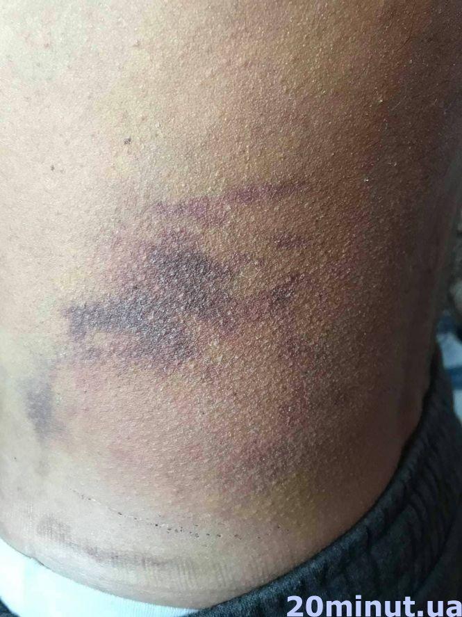 Новини Тернополя - фото з Розбій на дорозі поблизу Тернополя: «Мене били по голові ногами та погрожували спалити хату» Розбій на дорозі поблизу Тернополя: «Мене били по голові ногами та погрожували спалити хату», фото №3 на сайті 20minut.ua