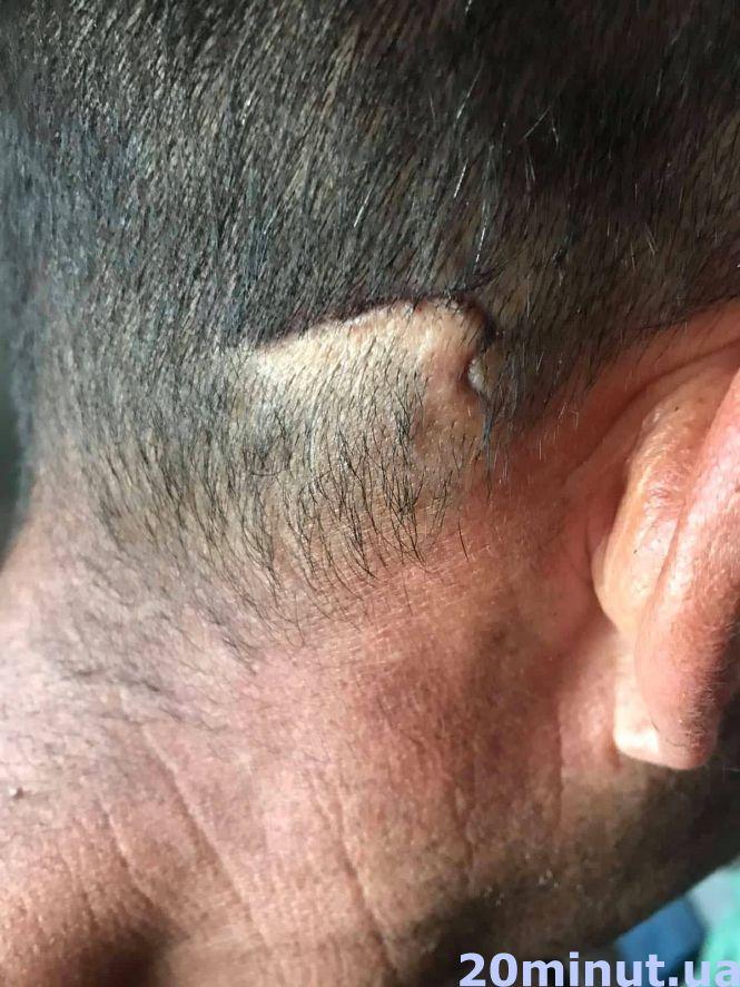 Новини Тернополя - фото з Розбій на дорозі поблизу Тернополя: «Мене били по голові ногами та погрожували спалити хату» Розбій на дорозі поблизу Тернополя: «Мене били по голові ногами та погрожували спалити хату», фото №1 на сайті 20minut.ua