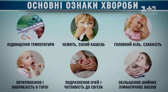 Кір в області: за тиждень захворіло 22 людини, з початку року — 3995, фото №1 на сайті 20minut.ua