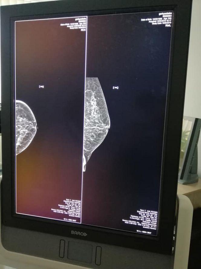 У Тернопільському онкодиспансері відкрили мамологічний кабінет, фото №7 на сайті 20minut.ua