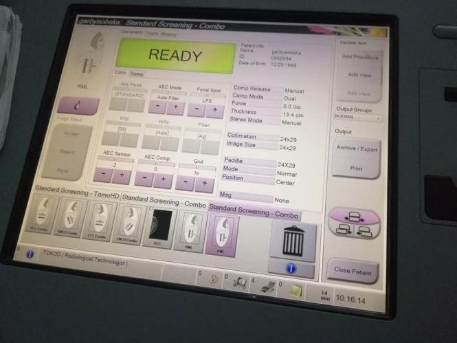 У Тернопільському онкодиспансері відкрили мамологічний кабінет, фото №5 на сайті 20minut.ua