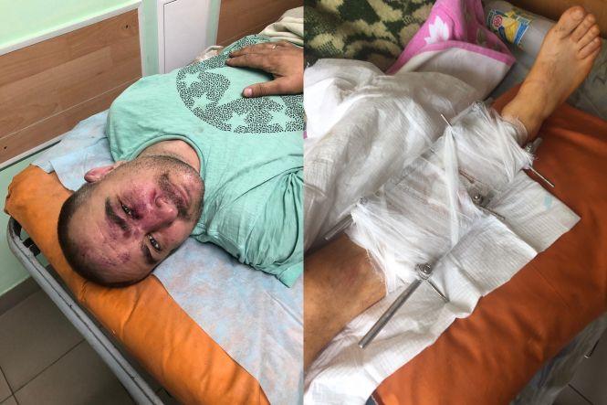 Новини Вінниці - фото з Горілчаний бізнес «кришували» полковники? Вінничанин розповів, як зв’язався з людьми в погонах Горілчаний бізнес «кришували» полковники? Вінничанин розповів, як зв’язався з людьми в погонах, фото №4 на сайті 20minut.ua