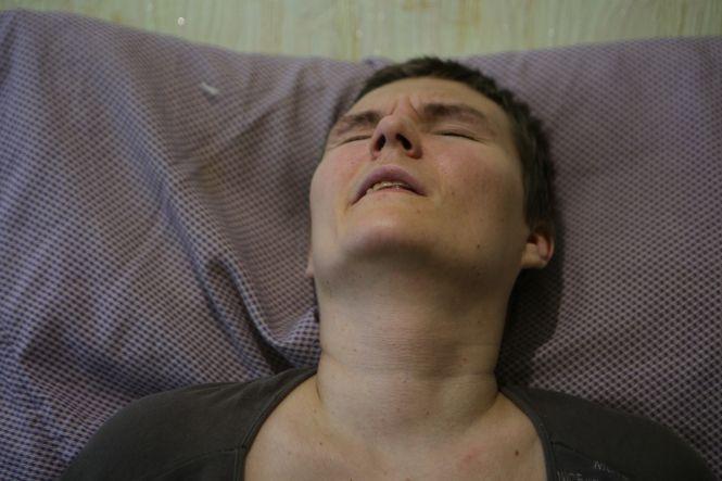 «Лікар сказав, краще б у неї був рак». Як живеться Светі з розсіяним склерозом, фото №4 на сайті 20minut.ua