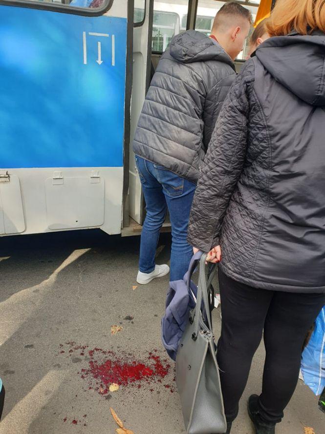 Новини Вінниці - фото з Кров на асфальті: на Соборній тролейбус збив чоловіка Кров на асфальті: на Соборній тролейбус збив чоловіка, фото №5 на сайті 20minut.ua