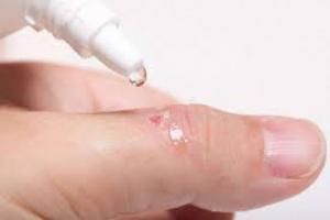 Новини Житомира - фото з Стереотипам – ні! Медичні міфи, в які люди досі вірять Стереотипам – ні! Медичні міфи, в які люди досі вірять, фото №2 на сайті 20minut.ua