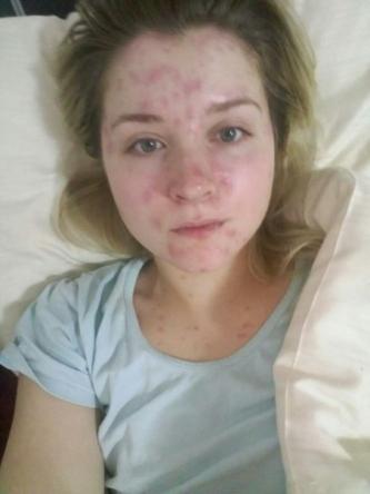 Новини Вінниці - фото з «Ваша сестра розуміє, що помирає». Про життя в очікуванні трансплантації «Ваша сестра розуміє, що помирає». Про життя в очікуванні трансплантації, фото №3 на сайті 20minut.ua