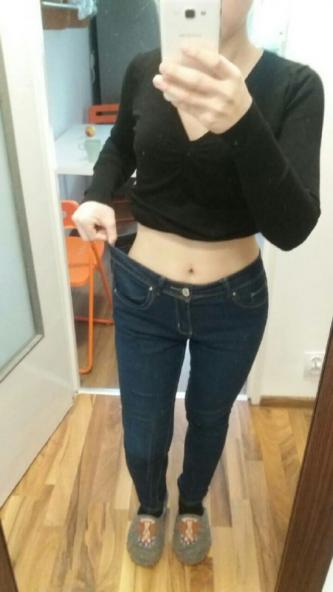 Новини Вінниці - фото з «Ваша сестра розуміє, що помирає». Про життя в очікуванні трансплантації «Ваша сестра розуміє, що помирає». Про життя в очікуванні трансплантації, фото №2 на сайті 20minut.ua