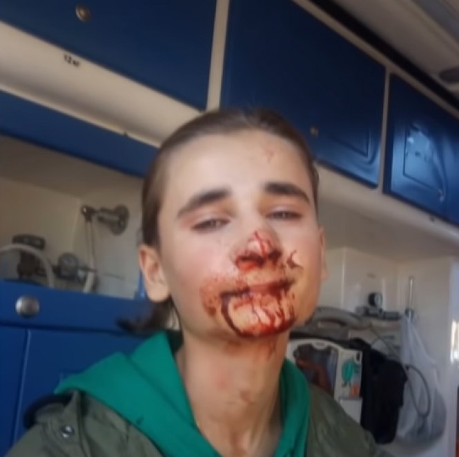 В Іллінцях сусіди побили 16-річного хлопця, який зробив їм зауваження на сайті 20minut.ua В Іллінцях сусіди побили 16-річного хлопця, який зробив їм зауваження, фото №2 на сайті 20minut.ua