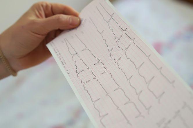 Новини Вінниці - фото з Зупиніть аритмію, щоб вона не зупинила ваше серце! (Новини компаній) Зупиніть аритмію, щоб вона не зупинила ваше серце! (Новини компаній), фото №4 на сайті 20minut.ua