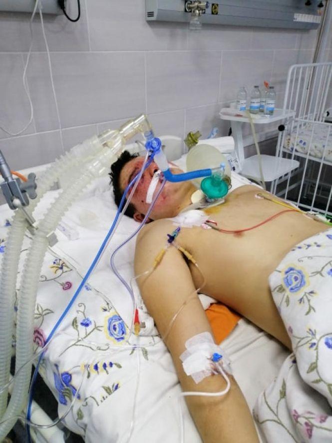 Новини Вінниці - фото з «Дивіться, нелюди, що ви наробили. Вас все одно знайдуть». В Іллінцях побили 17-річного юнака «Дивіться, нелюди, що ви наробили. Вас все одно знайдуть». В Іллінцях побили 17-річного юнака, фото №1 на сайті 20minut.ua