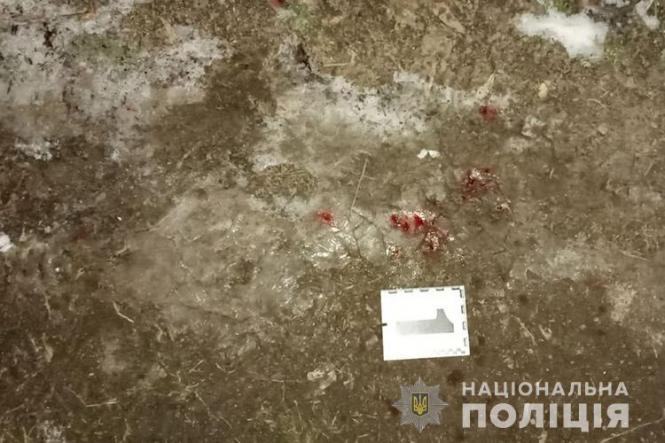 Новини Тернополя - фото з "Молотком по голові": на Монастирищині побили ветерана АТО, бо звернув увагу на торгівлю алкоголем "Молотком по голові": на Монастирищині побили ветерана АТО, бо звернув увагу на торгівлю алкоголем, фото №3 на сайті 20minut.ua