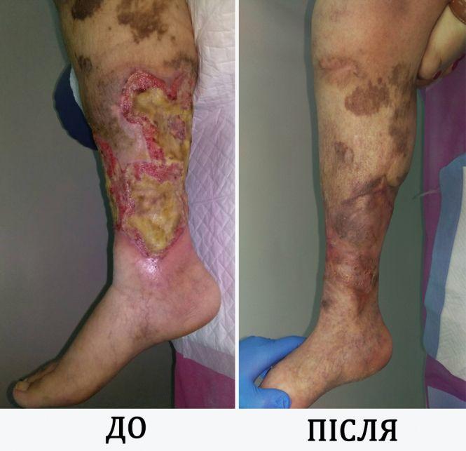 Ідеальний тандем: професіоналізм лікаря та сила волі пацієнта (новини компаній), фото №1 на сайті 20minut.ua