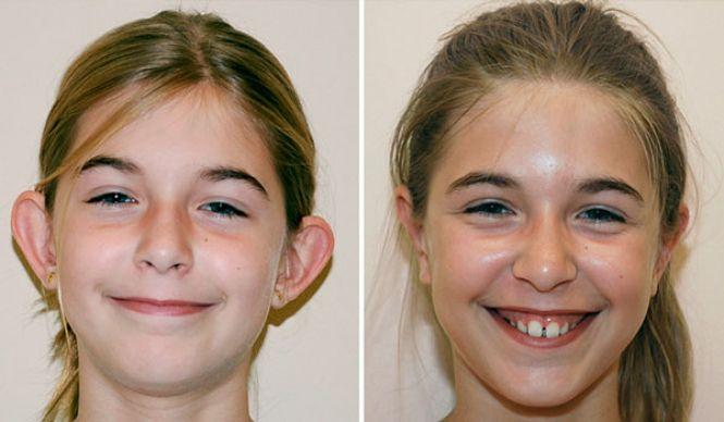 Новини Вінниці - фото з Пластичні операції у Вінниці: скільки коштує зробити груди, ніс і повіки? Пластичні операції у Вінниці: скільки коштує зробити груди, ніс і повіки?, фото №5 на сайті 20minut.ua