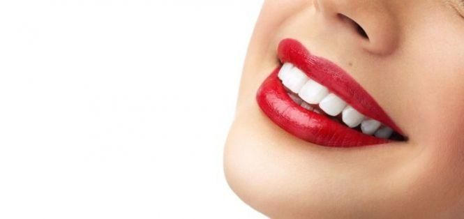 Новини Вінниці - фото з Відбілити зуби і вижити: стоматолог розповіла про користь і шкоду відбілювання Відбілити зуби і вижити: стоматолог розповіла про користь і шкоду відбілювання, фото №5 на сайті 20minut.ua