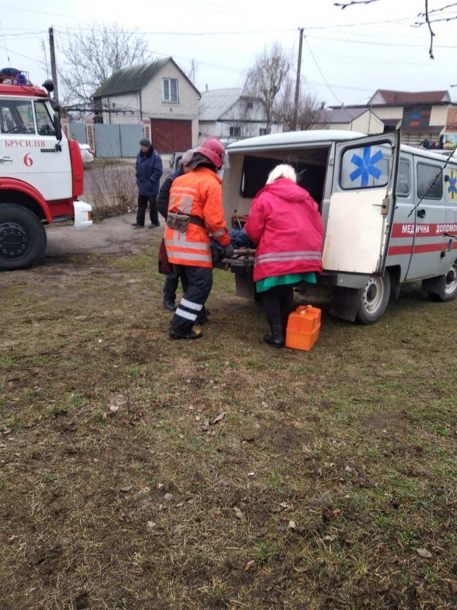 Через куріння в Брусилові ледь не згоріли двоє чоловіків, фото №2 на сайті 20minut.ua