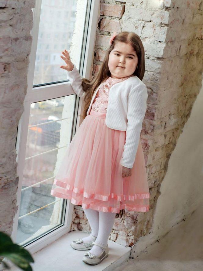 На підтримку дітей з рідкісними захворюваннями у Тернополі організовують фотовиставку (оновлене), фото №3 на сайті 20minut.ua