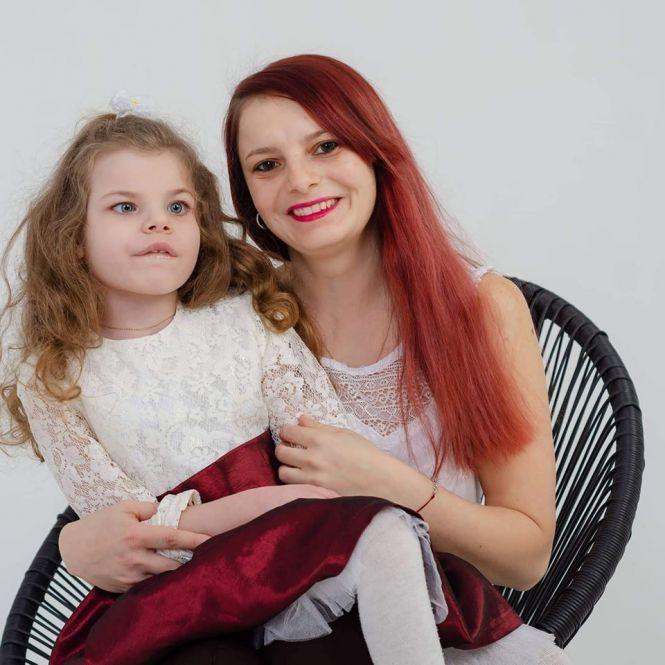 На підтримку дітей з рідкісними захворюваннями у Тернополі організовують фотовиставку (оновлене), фото №1 на сайті 20minut.ua