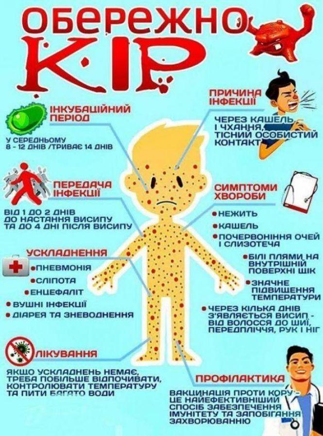 Знову спалах кору:  за тиждень в області захворіло п'ять людей, фото №1 на сайті 20minut.ua