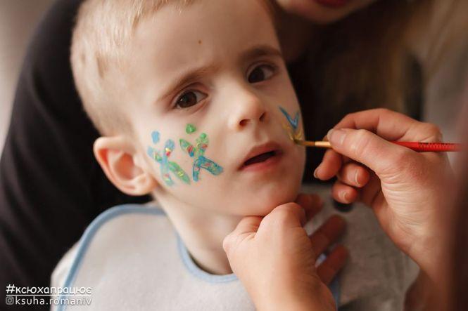 На підтримку дітей з рідкісними захворюваннями у Тернополі організовують фотовиставку (оновлене), фото №4 на сайті 20minut.ua