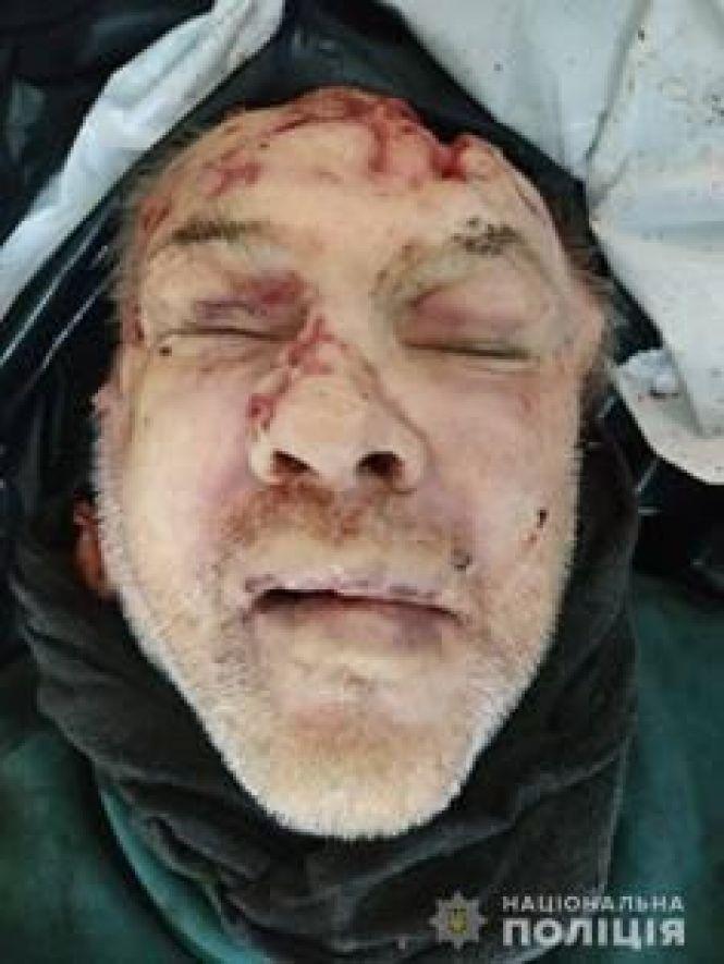 На Тернопільщині 17 днів не можуть встановити особу чоловіка, який загинув на колії (обережно - фото 18+), фото №1 на сайті 20minut.ua