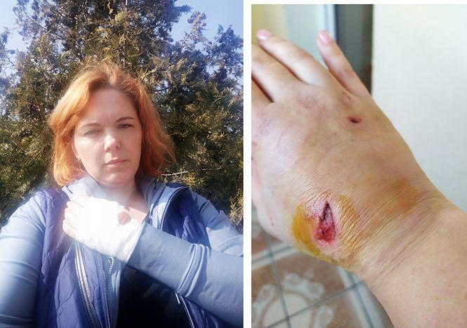 Новини Тернополя - фото з Впіймали собаку, який накинувся на Оксану Малінович і пошкодив їй руку Впіймали собаку, який накинувся на Оксану Малінович і пошкодив їй руку, фото №1 на сайті 20minut.ua