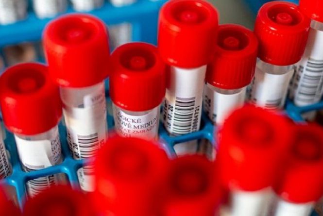 Новини Вінниці - фото з Важливе за вчора. Найцікавіші новини 8 квітня, які ви могли пропустити Дані про COVID-19 на 8 квітня: +206 випадків за добу в Україні та +8 на Вінниччині (НАЖИВО)