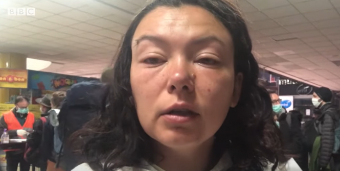 Новини Вінниці - фото з З болівійських джунглів до Вінниці за 1,5 тисячі доларів: історія евакуації блогерки Даші З болівійських джунглів до Вінниці за 1,5 тисячі доларів: історія евакуації блогерки Даші, фото №5 на сайті 20minut.ua