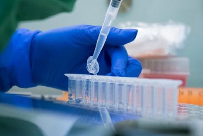 Коронавірус в області: пояснили чому Вінниччина 20 квітня дала «нульовий результат»